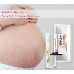 ZS Creme Reparador de Estrias com Fator de Crescimento para Remoção de Estrias, Cicatrizes de Acne e Tratamento de Estrias Gravídicas - Product Image 1