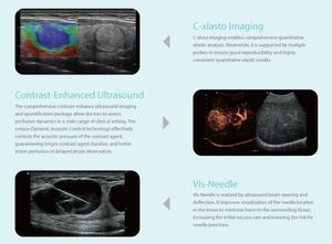 Appareil d'échographie Doppler couleur 4D Sonoscape P12Elite avec grand écran pour l'obstétrique / la cardiologie / l'abdomen - Product Image 4