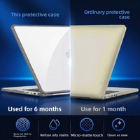 Étui de protection Neo pour MacBook 13 pouces, résistant aux rayures, coque en plastique TPU+PC