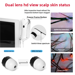 Scalp Analyzer <b>Machine</b> 15 Inch HD Screen Hair Follicle Detection Face <b>Analysis</b> AI Device for Salon - Product Image 3