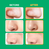 ELAIMEI – Patch hydrocolloïde pour nettoyage en profondeur du front, du nez et des pores du menton, dissolvant de points noirs, Zone T