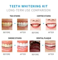 Kit de Blanqueamiento Dental LED RIJIESMILE, Geles sin Peróxido, Certificado CE, Rápido y Efectivo, Marca Privada, Uso Doméstico TW-W1