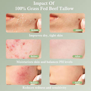 FDA-zertifizierter Feuchtigkeit creme hersteller Bio-Grass-gefütterter geschlagener Rinder talg und Honig balsam für trockene Körper hände - Product Image 5