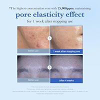 Sérum liquide booster facial Medicube Zero Shot 25 000 Ppm à base de spicules, soin des pores, élimination des cellules mortes, soin de la peau coréen
