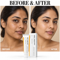 Crème Visage Réparatrice et Hydratante OEM/ODM/OBM POEE+DARKSPOT à l'Acide Tranexamique et à la Niacinamide 35ml pour Peaux Sèches – Usage Jour