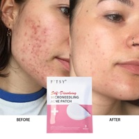 Patch micro-aiguille anti-acné et anti-acné OEM de marque privée Patch anti-acné pour le visage à l'acide hyaluronique Vente à chaud