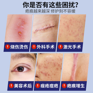 Gel Reparador de Colágeno Recombinante Médico Farmacéutico Yaji 20g, Previene la Pigmentación de Cicatrices, Cuidado de Heridas - Product Image 5