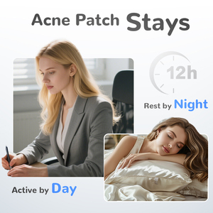 12パッチ/シート丸いにきびパッチHydrocolloidスポットにきびにきびパッチ顔用 - Product Image 3