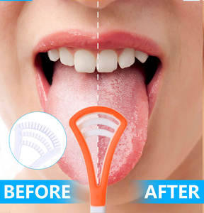 Raspador de Lengua Joycare OC-102 de Silicona Ancha y Colorida con Cabezal de Goma y Lengua de Plástico para una Limpieza Efectiva, Diseño Portátil - Product Image 4