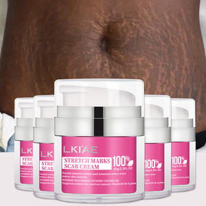 Crème <span class=keywords><strong>Anti</strong></span>-Vergetures Naturelle à la Vitamine E, Sûre et <span class=keywords><strong>Efficace</strong></span> pour l'Élimination en Profondeur des Vergetures Post-Grossesse – Direct Usine - Product Image 1