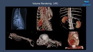 Scanner CT à faisceau conique vétérinaire pour clinique vétérinaire spécialisée en dentisterie <span class=keywords><strong>et</strong></span> en orthopédie - Product Image 3