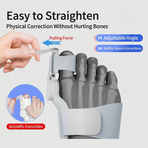 Correttore <span class=keywords><strong>per</strong></span> Hallux Valgus, Separatore <span class=keywords><strong>Dita</strong></span>, Dispositivo <span class=keywords><strong>per</strong></span> <span class=keywords><strong>Dita</strong></span> Divaricate, <span class=keywords><strong>Protezione</strong></span> in Silicone <span class=keywords><strong>per</strong></span> <span class=keywords><strong>Dita</strong></span> e Falangi <span class=keywords><strong>dei</strong></span> Bambini, Allevia il Dolore - Product Image 6