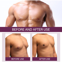 Spray de réduction de la gynécomastie, accélérateur de raffermissement des muscles mammaires, spray tenseur pour la poitrine, brûleur de cellulite, fitness musculaire 30ml