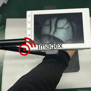 Desain baru pencari pembuluh darah inframerah penampil Nadi LCD pencari Nadi untuk ruangan darurat dan klinik dokter hewan - Product Image 2