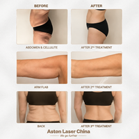 Appareil professionnel de massage corporel pour la réduction de la cellulite avec technologie 360 °   Rouleau à vitesse réglable pour le remodelage corporel en salons de beauté
