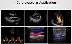 Harga Mesin <span class=keywords><strong>Echocardiography</strong></span> Portabel Sonoscape X3 X5 untuk Penggunaan Manusia/Hewan - Product Image 6