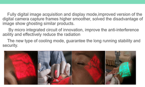 Fillter and IV Vessel <strong>Viewer</strong> VF12 Ergonomic Design High Technology Portable Vein Finder Locator with Promotional Price - Product Image 5