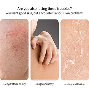 <span class=keywords><strong>Crema</strong></span> Exfoliante para la Queratosis Pilaris, para Uso Corporal Externo, Hidrata y Mejora la Piel Áspera - Product Image 5