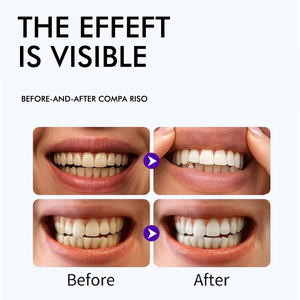Bandes <span class=keywords><strong>blanchissantes</strong></span> professionnelles pour les dents, sourire éclatant et magnifique, sans sensibilité, sans peroxyde, 7 paires, 14 bandes - Product Image 4