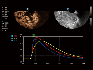 Sonoscape P80 Sistema de Ultrasonido Doppler Color de Alta Calidad y Sistema de Ultrasonido con Carro para Uso Veterinario - Product Image 5