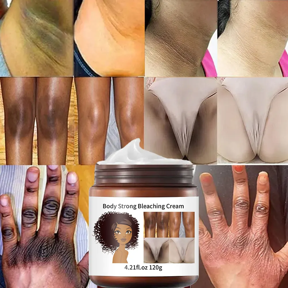 Private Label Maatwerk Vrouwelijk Lichaam Privé Deel Knieën En Ellebogen Sterke Whitening Crème 120G Lightening Whitening Cream