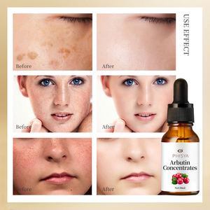 Siero viso collagene vitamina A B C E siero antirughe Anti-età arbutina cura della pelle siero viso - Product Image 6