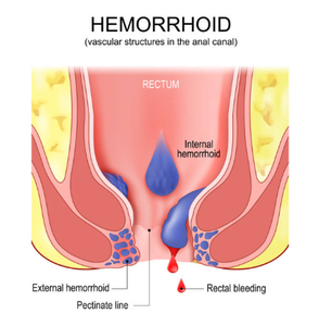 Ginekologi 980 1470nm Laser Atrofi Vagina <span class=keywords><strong>Fibroid</strong></span> Rahim <span class=keywords><strong>Fibroid</strong></span> Ovarium Perawatan Bedah Klinik Wasir EVLT PLDD THT - Product Image 6