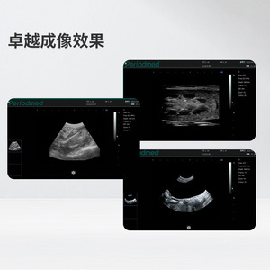 Échographe vétérinaire portable Promax Pet Ultrasound PU-VP081A pour le diagnostic gastro-intestinal des chiens, équipement médical à semi-conducteurs - Product Image 2