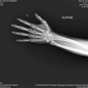 Độ Phân Giải Cao 17*17 Không Dây Phẳng <span class=keywords><strong>Detector</strong></span> DR Hệ Thống Chẩn Đoán Cho Con Người Thú Y Sử Dụng Điện Của Nhãn Hiệu Thép Kim Loại - Product Image 4