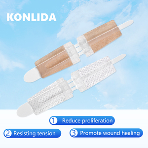 Perangkat penutup luka kekuatan tinggi, perangkat penutup luka perekat medis bedah untuk perawatan luka - Product Image 2