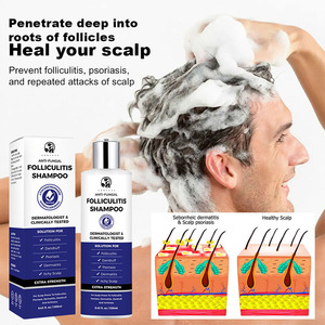 <span class=keywords><strong>Shampooing</strong></span> apaisant personnalisé au logo, anti-pelliculaire, traitement à l'acide salicylique pour la folliculite, le meilleur soin capillaire - Product Image 6