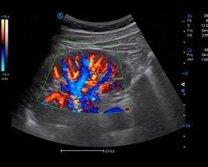 Échographe Doppler Couleur SIUI Apogee C2 de Haute Qualité et Économique avec Longue Durée de Vie pour Usage Vétérinaire - Product Image 4
