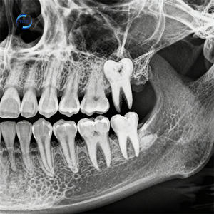 Electric 60KV/70KV X-ray Machine <strong>Dental</strong> Portable <strong>Dental</strong> <strong>Unit</strong> X Ray with Sensor - Product Image 6