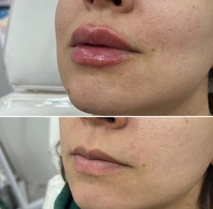 Naturellement dodu du <span class=keywords><strong>volume</strong></span> des lèvres Pouty Tingling Hydratant Lip <span class=keywords><strong>Filler</strong></span> Lip Plumper Gloss Private Label - Product Image 6