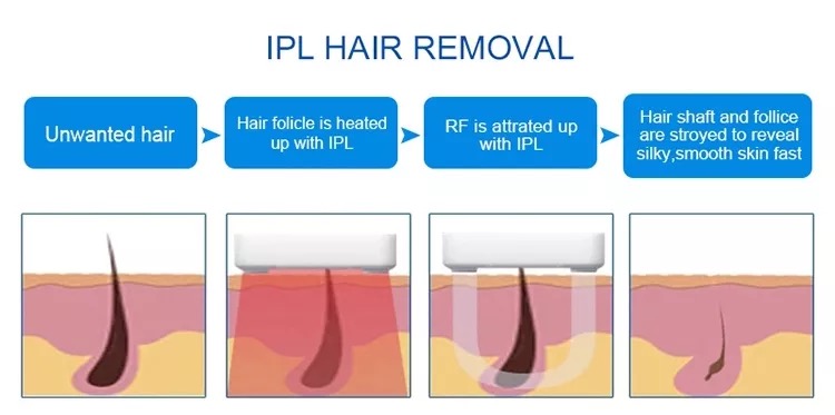 Factory Price Permanent Hair Removal Painless Ipl Shr Hair Removal Portable Ipl Skin Treatment System