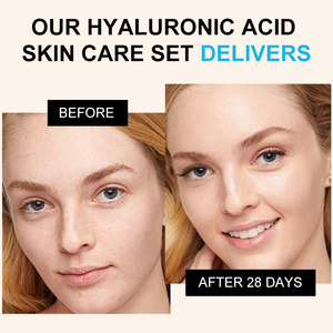 <span class=keywords><strong>Kit</strong></span> <span class=keywords><strong>de</strong></span> viaje en 4 pasos para el cuidado diario <span class=keywords><strong>de</strong></span> la piel con infusión <span class=keywords><strong>de</strong></span> ácido hialurónico coreano - Product Image 3