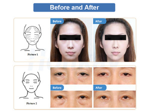 2025 chân không bạch huyết thoát nước cơ thể massage chân không Con lăn <span class=keywords><strong>Shaper</strong></span> Cellulite chân không Con lăn máy - Product Image 5