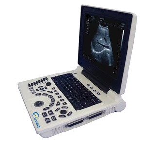 Échographe portable 12 pouces avec sondes de diagnostic, machine à ultrasons médicale BW pour ordinateur portable avec scanner, vétérinaire et humain BW20 - Product Image 1