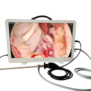 Peralatan pencitraan medis kamera endoskopi portabel kamera endoskopi 4k untuk kantung ENT/laparoskopi/solenoid/urologi