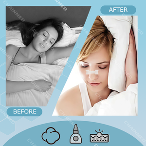 Bandelettes Dilatatoires Nasales Magnétiques CM pour le Ronflement – Bande Nasale Hypoallergénique Respirante pour une Meilleure Respiration et un Sommeil Amélioré - Product Image 3