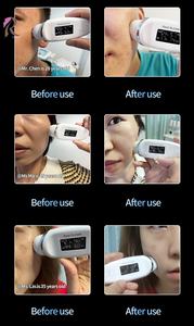 Máquina de Hidrodermoabrasión Facial 3 en 1, Rejuvenecimiento Facial, <span class=keywords><strong>Spa</strong></span>, Gran Venta - Product Image 3