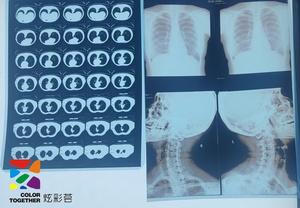 ฟิล์มเอ็กซ์เรย์สีน้ำเงินสำหรับการแพทย์แบบขายส่งระหว่างประเทศ พร้อมมุมโค้งมนและรอยบากสำหรับระบุข้อมูลด้านพิมพ์ - Product Image 5