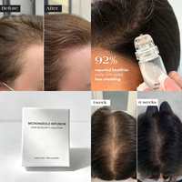 Sérum Capillaire Anti-Chute Botanique Soin du Cuir Chevelu Peptide de Cuivre Huile de Romarin Traitement Capillaire à la Kératine pour la Repousse – Kit Complet