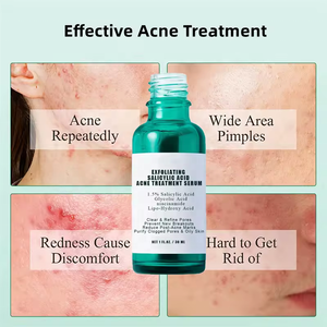Acide salicylique acide acné sérum rétrécir les Pores exfoliant supprimer l'acné points noirs soins de la peau sérum pour le visage - Product Image 2