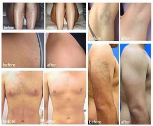 Новая Питьевая 1500 Вт диодо Тройная машина для удаления волос с 3 длинами льда, титановая 755 808 1064nm Диодная лазерная эпиляция - Product Image 6