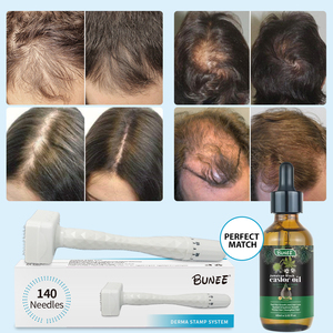 0-3 mét có thể điều chỉnh 140pin/100pin microneedle demarle tem tóc tinh dầu Derma tem cho điều trị mụn trứng cá Derma tem hệ thống - Product Image 2