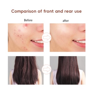 Appareil de beauté facial portable 4 en 1, traitement de l'acné par électrodes, thérapie à l'ozone, baguette de beauté faciale haute fréquence - Product Image 3