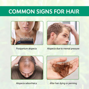 Aceite de <span class=keywords><strong>Romero</strong></span> orgánico Natural para tratamiento del cabello para mujeres negras, productos para el cuidado del cabello, marca privada, venta al por mayor - Product Image 4