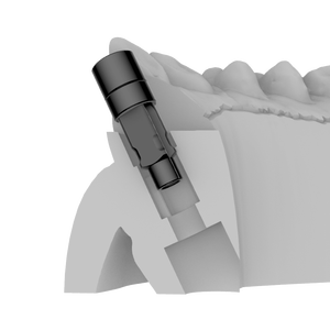 <span class=keywords><strong>Straumann</strong></span> Tissue Level Implant-kompatibles Dental 3D Digital Analogmodell mit kostenloser Bibliothek - Product Image 5
