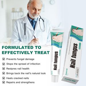 20g Formula Herbal Alami Bersertifikat CE Kelas I Krim Antibakteri untuk Jamur Kuku dengan Masa Simpan 3 Tahun Buatan Cina - Product Image 4